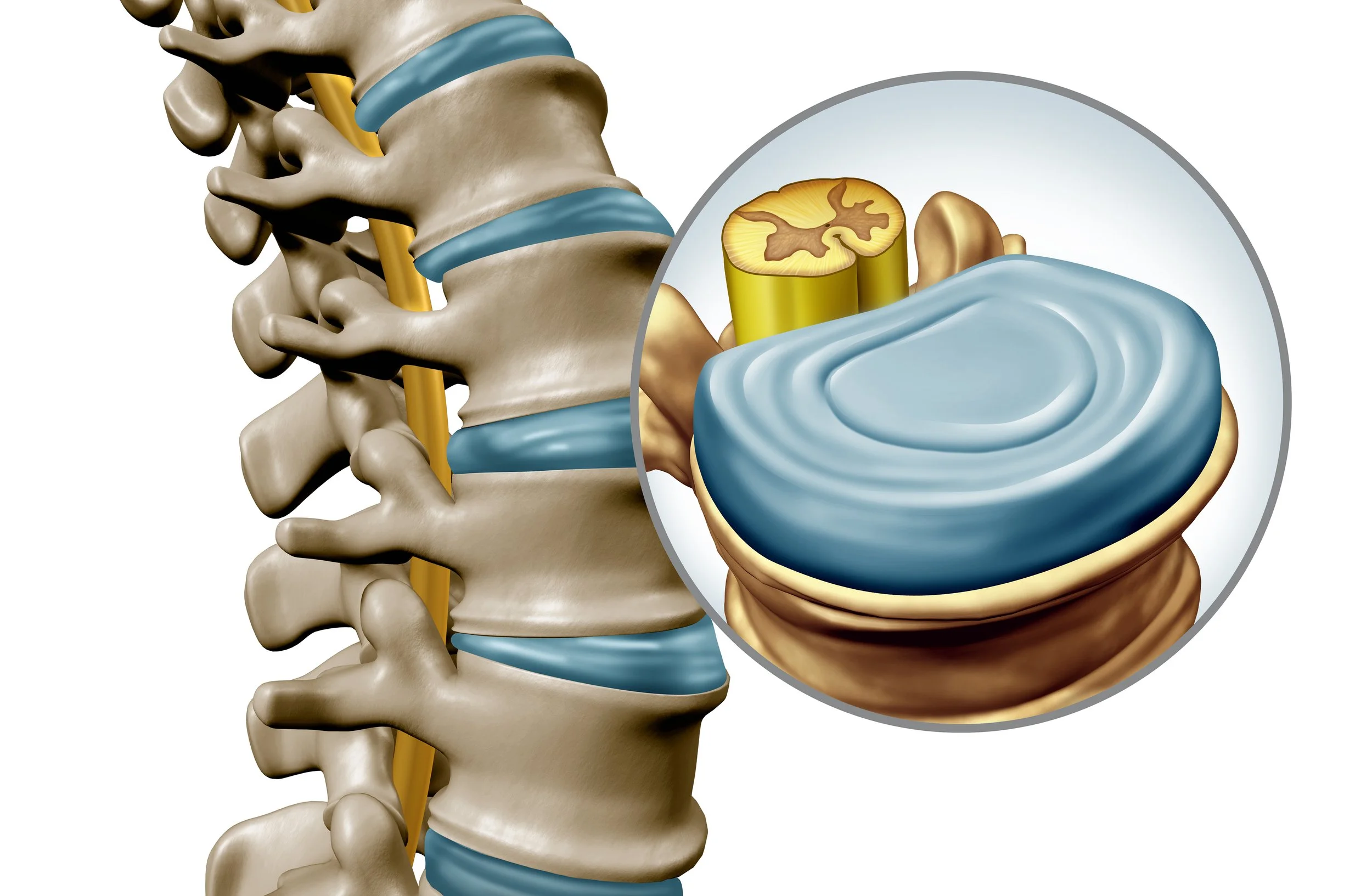 Anatomie d’un disque intervertébral sain dans la colonne vertébrale